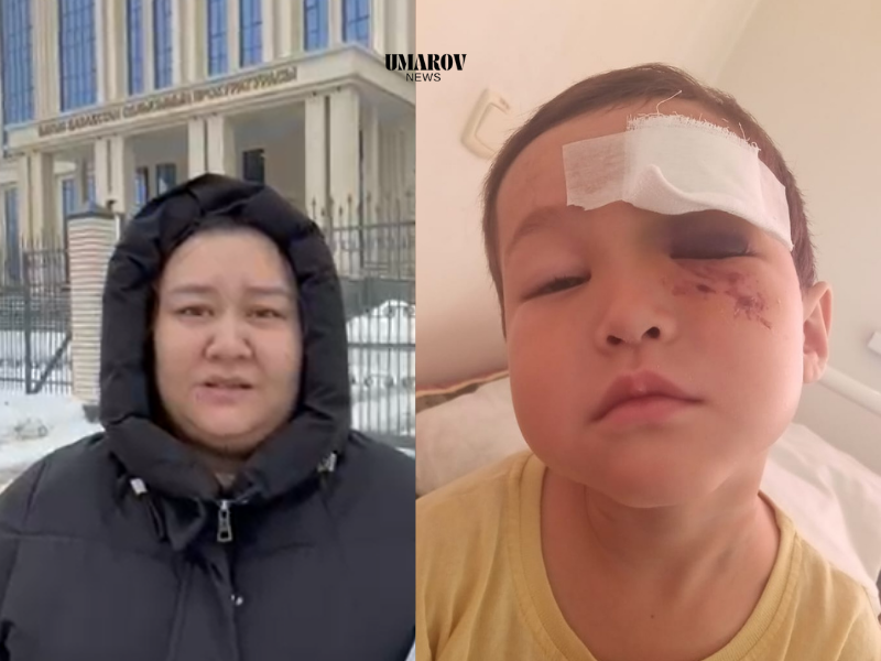 В ЗКО мать 5-летнего мальчика, потерявшего зрение на один глаз в спортзале, обратилась к Генпрокурору Казахстана